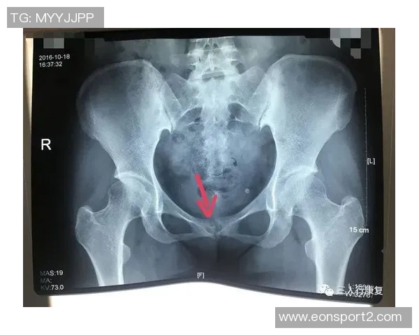 尼科威廉姆斯谈耻骨炎恢复过程并表示需带伤出战的挑战与决心